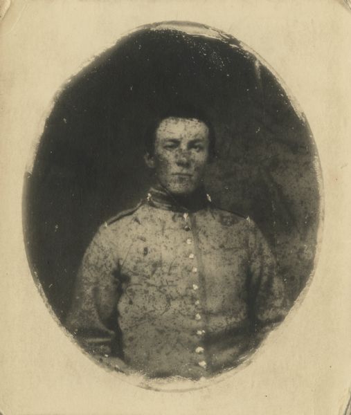 Waist-up carte-de-visite portrait of Hervie A. Dobson, Company K, 11th Veteran Reserve Corps.