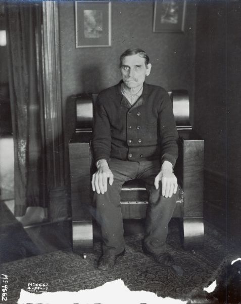 A man, who appears to be missing an eye, is sitting in a chair. The man is most likely a factory worker from International Harvester's McCormick Works in Chicago.
