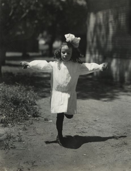 A girl from Sunnyside School balancing on one leg outdoors. She is wearing a dress and has a  large bow in her hair.