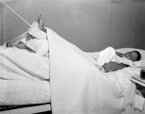 Charles Motisi lying in a hospital bed with his foot in traction at Madison General Hospital with the first football injury of the season.