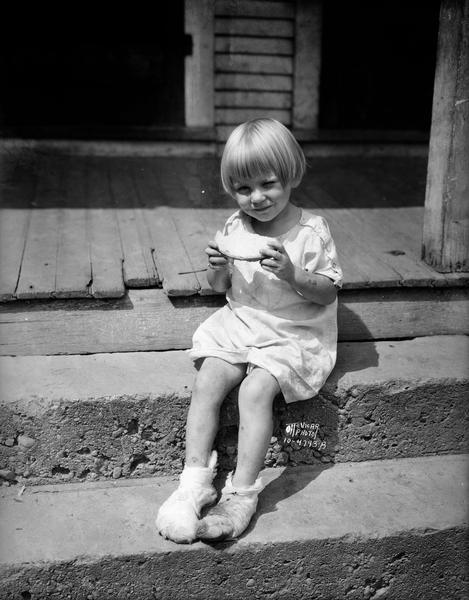 Carol Skuldt sitting outdoors on a stoop with bandaged burned feet from a brush fire. She is holding a food item.