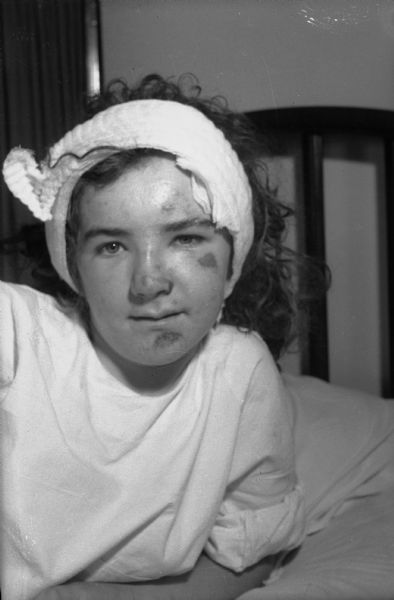 Photograph of Lois Bailey, who was thrown from the Tilt-a-Whirl ride at the Madison East Side Festival, suffering injuries to her face and head.