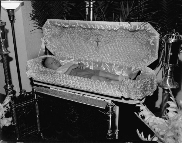 The body of Donald Bruer in his coffin.  Donald, 3 years old, fell from a third floor window and was impaled on a picket fence.