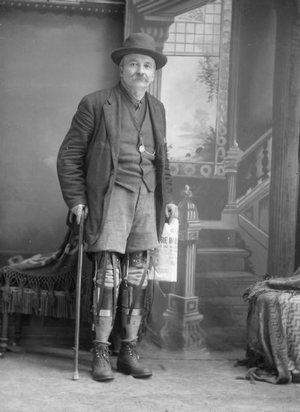 Studio portrait in front of a painted backdrop of William Tennant, standing with short pants that reveal  his prosthetic legs. He holds a newspaper in his left hand, balances on a cane in his right. A painted paper background depicts a stairway and window between fabric covered studio benches. He also wears a top coat, vest, a pocket watch on a chain, and a bowler.