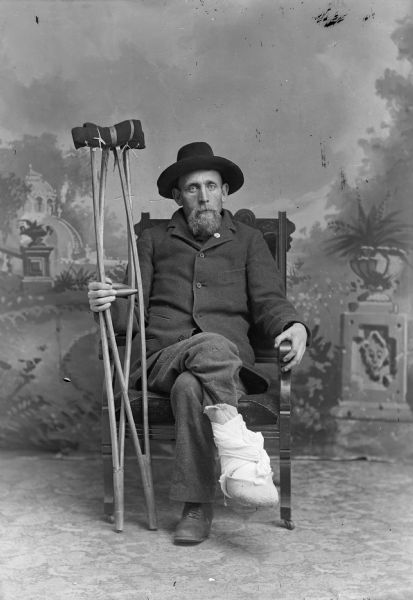A man with a bandaged foot sits in a chair holding crutches for a studio portrait in front of a painted backdrop. He is wearing a suit jacket, hat, and trousers.