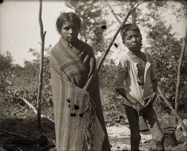 An unidentified young Ho-Chunk boy and girl with smallpox are standing outside of their home. The Ho-Chunk girl is wrapped in a shawl and is standing on the left, and the Ho-Chunk boy standing on the right is posing wearing only a shirt.