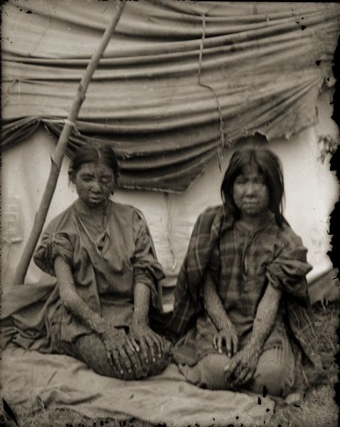 Two unidentified young Ho-Chunk girls with smallpox are kneeling outside their lodge. Some of the Ho-Chunk suffering from smallpox were quarantined during the 1901 outbreak.