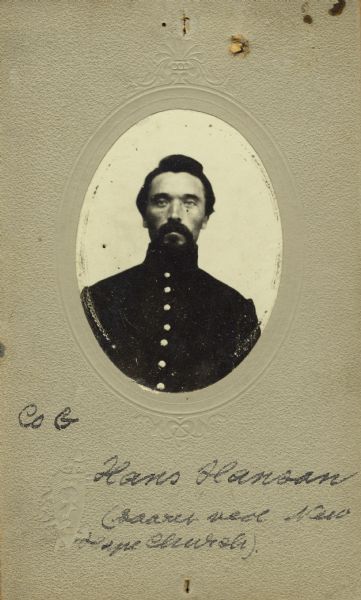 Quarter-length oval studio portrait of Hans Hanson, a corporal in Company G, 15th Wisconsin Infantry, in uniform. The following information was obtained from the Regimental and Descriptive Rolls, Volume 20: He resided in Beloit, Wisconsin. On November 22, 1861, he enlisted in Beloit, Wisconsin and was mustered into service in Madison, Wisconsin on December 12, 1861, at the age of 29. He was appointed to the rank of corporal on April 25, 1864. On May 27, 1864, he was severely wounded in the leg during the battle at New Hope Church, Georgia and was sent to a hospital in New Albany, Indiana. He was mustered out of service on January 14, 1865, in Madison, Wisconsin because the term of his service had expired.