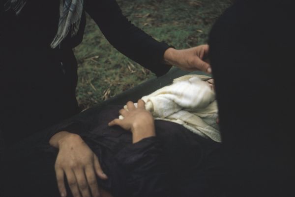 Vietnamese woman on a stretcher being carried to a helicopter for medical evacuation. The woman was injured during a Viet Cong raid on the village of Vinh Quoi. Her neck is wrapped in a cloth and two other people stand at her sides.