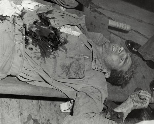 Corporal William (Bill) Fenton lays badly wounded, waiting for medical treatment. There is a note on his shirt that reads "urgent." Fenton survived the injury.