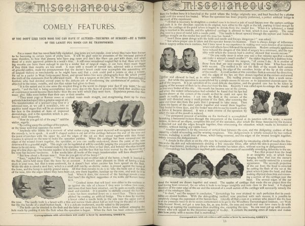 An illustrated article in <i>Godey's Ladies Book</i> regarding "triumph of surgery" to improve one's facial features.