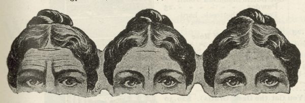 An illustration from the article "Comely Features" in <i>Godey's Ladies Book</i>, showing elimination of forehead wrinkles.