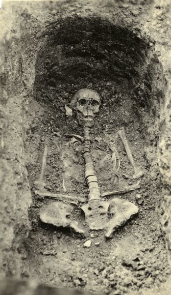 Skeletal remains of William Nelson or Samuel Warren, one of two men buried in the first cemetery in Madison located on what is now Bascom Hill.